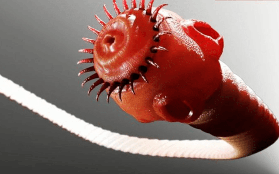 worm parasite from human body