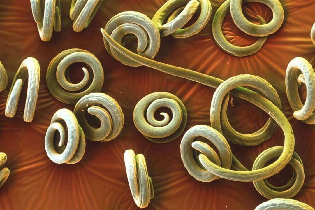 worm parasites from human body