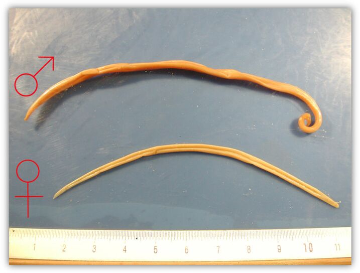 Life-sized female and male roundworms