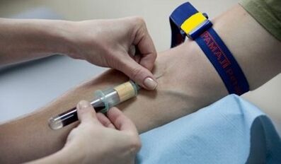 How to prepare for parasitic testing