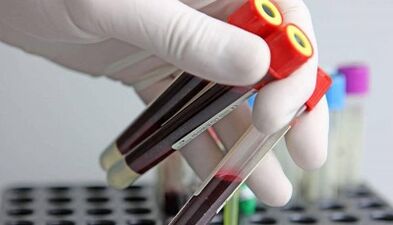How to test for parasites in the body