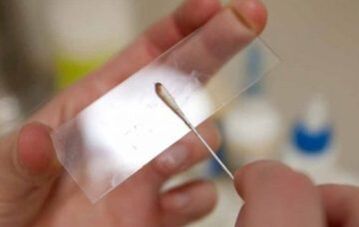 What testing should be done for parasites