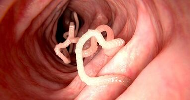 Parasites in the human body