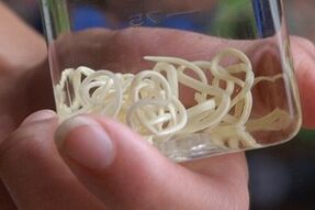 parasites from human body