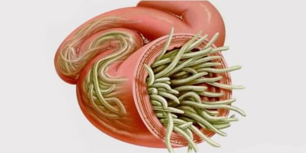 parasites in human intestine